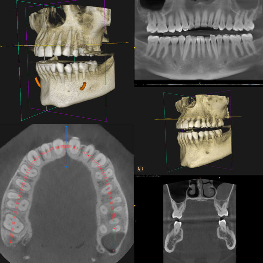 roentgen 3D DVT
